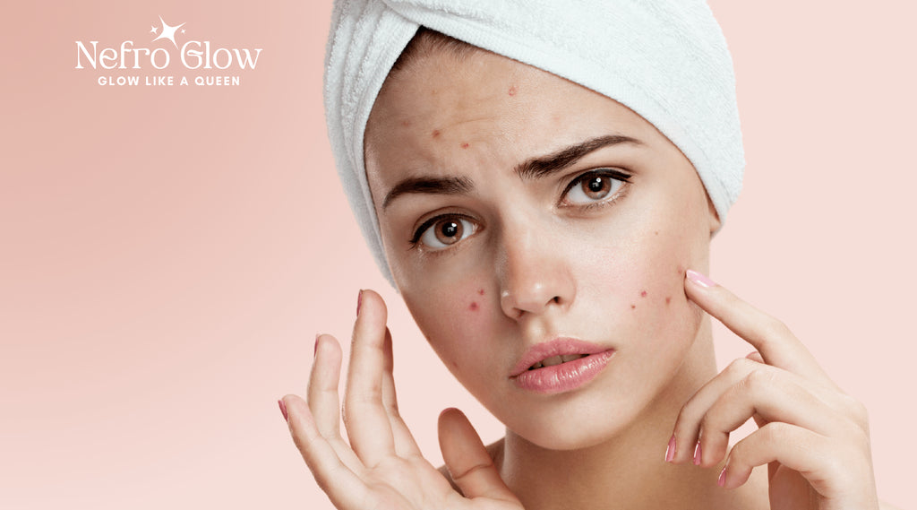 كيفية التعامل مع حب الشباب الناتج عن التغيرات الهرمونية - Nefro Glow