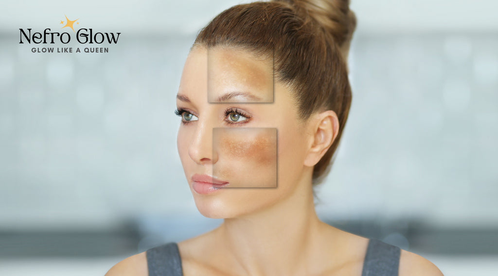 أفضل واقي شمس للبشرة التي تعاني من البقع الغامقة