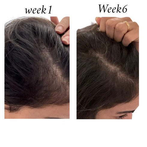 رو افريكان بخاخ لتعزيز بصيلات الشعر - Raw african